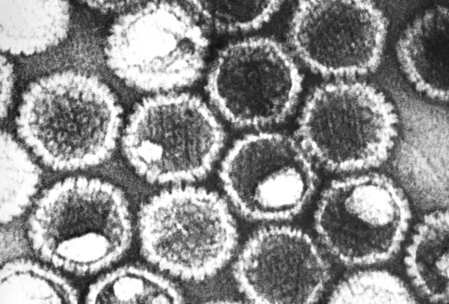 virus of herpes