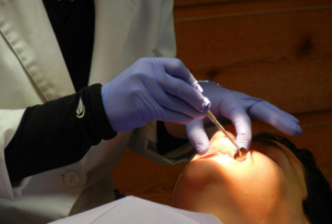 dental braces